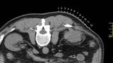 Fast Find CT Biopsy Grid