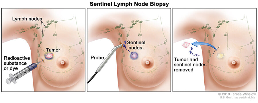 Unit Doses for Sentinel Node Biopsy